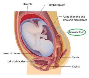 baby in womb with arrows pointing at different parts of the womb with emphasis on location of amniotic fluid