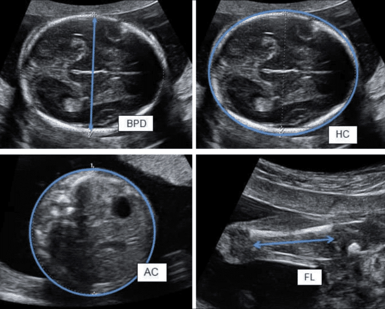 how-does-the-sonographer-determine-my-baby-s-weight