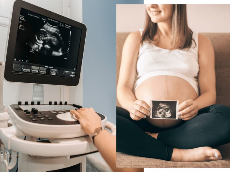 prenatal-ultrasounds-all-you-need-to-know-3d-4d-hd-ultrasound