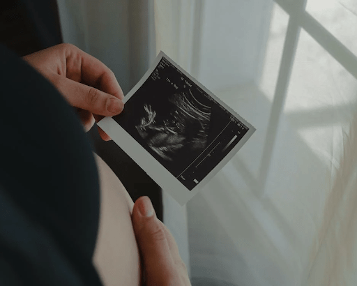 How Much Does An Obstetric Ultrasound Scan Cost?