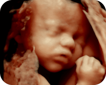 3D Ultrasound Baby with visible hands